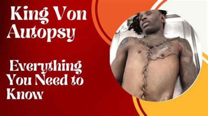 Understanding King Von's Death Autopsy: A Deep Dive