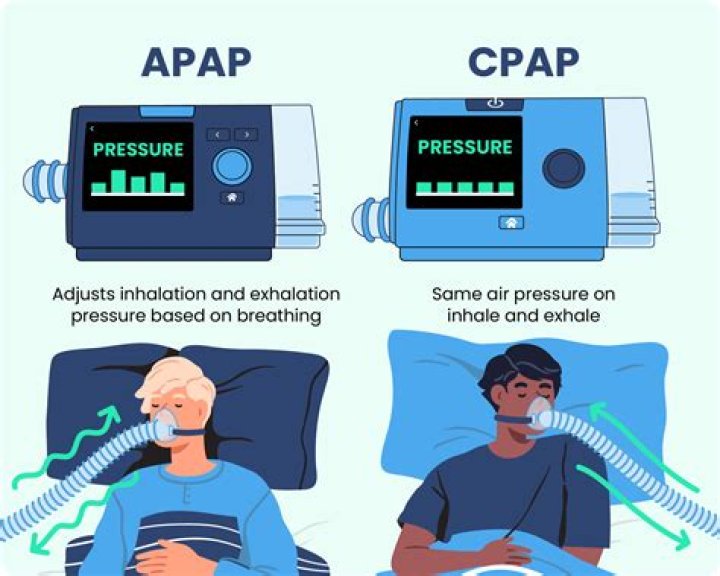 Understanding the Fixed Pressure CPAP Machine: A Comprehensive Guide
