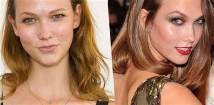 Unveiling Karlie Kloss's Plastic Surgery Journey: Before And After