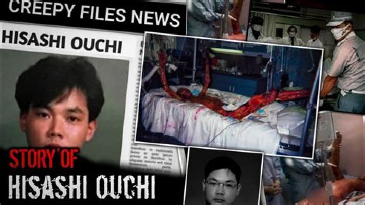 Unveiling The Truth: The Hisashi Ouchi Autopsy