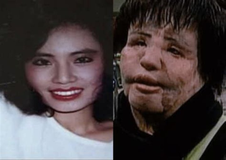 What Is Hang Mioku Doing Now? Close To Death After Surgery