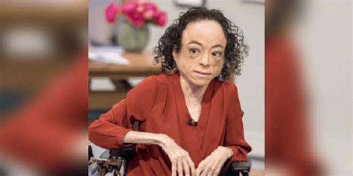 What is Liz Carr Net Worth 2024: A Comprehensive Financial Overview