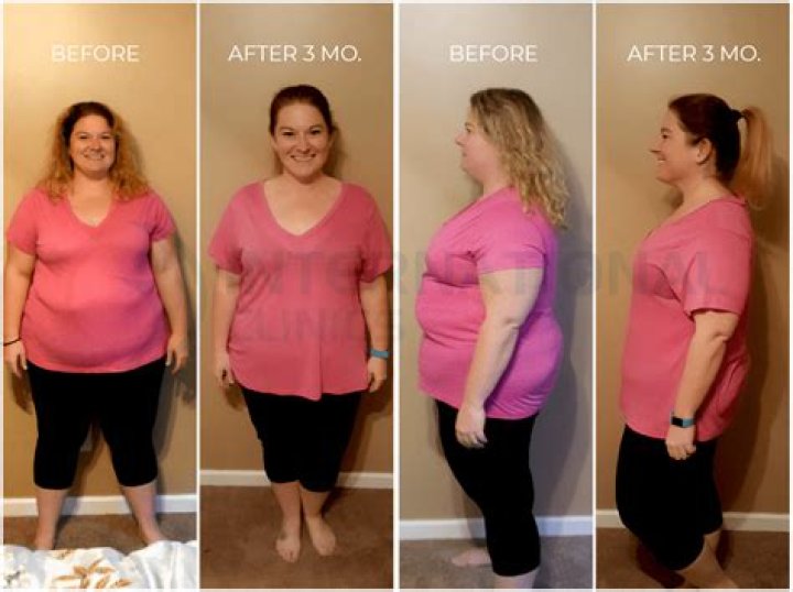 What Procedures Did She Undergo? Before & After Pictures Analyzed!
