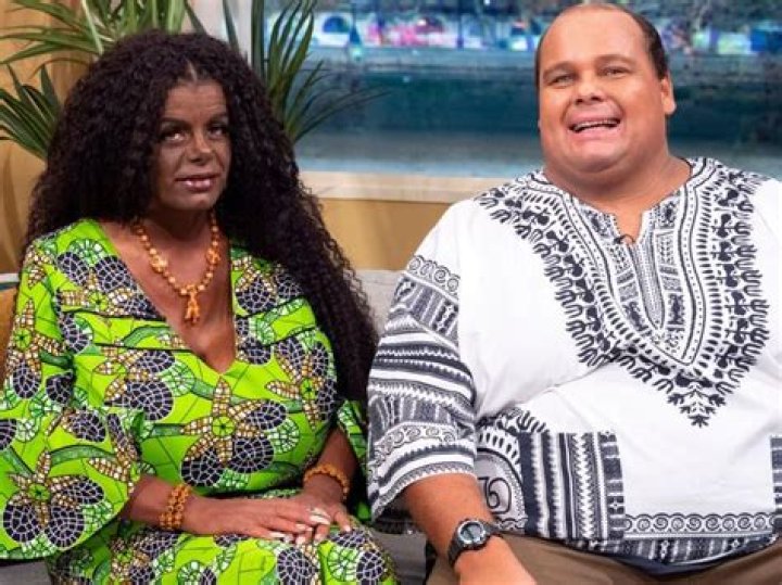 WHITE MODEL MARTINA BIG AND HER HUSBAND WHO ‘CHANGED THEIR RACE’ CLAIM THEIR BABIES WILL ‘COME OUT BLACK’
