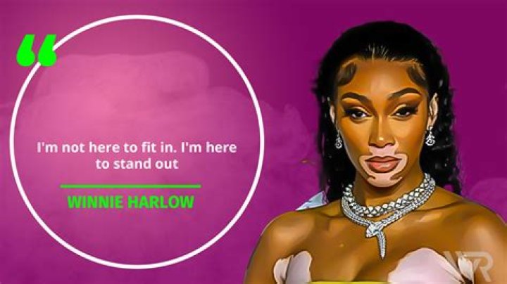 Winnie Harlow Net Worth 2024
